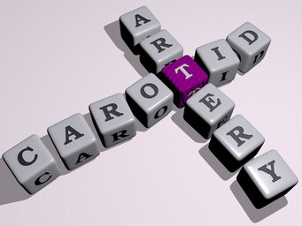 What is the recovery time for carotid artery surgery? | JAR9 What is the recovery time for carotid artery surgery? | JAR9