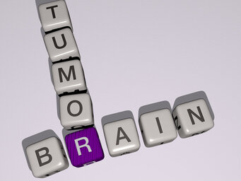 How do you rule out a brain tumor?