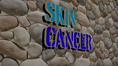Can a skin cancer be itchy?